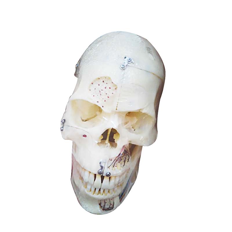 UM-5007 Human Skull Reconstucted Model(divided in to 10 Parts)